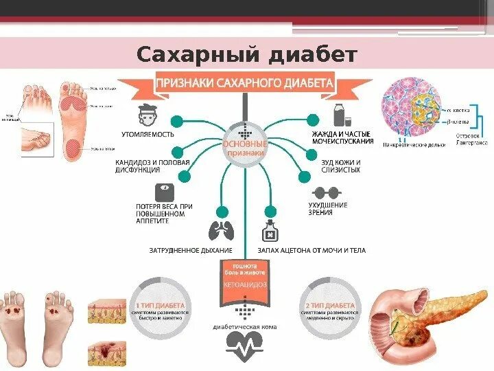 Риск сахарного диабета. Факторы способствующие развитию сахарного диабета. факторы риска при сахарном диабете. факторы риска развития сахарного диабета. памятка факторы риска сахарного диабета.