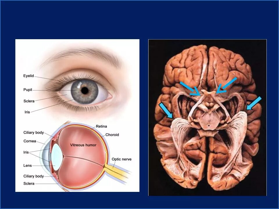 Два зрительных нерва. II пара, n. Opticus. Зрительный нерв (n. Opticus) – II пара. Глазной нерв расположение. Зрительный черепной нерв.