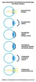 С каких лет можно линзы