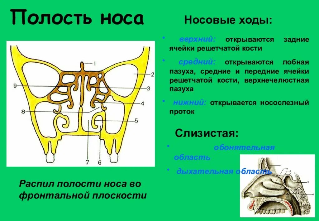 В верхний носовой ход открывается пазуха. Распил полости носа во фронтальной плоскости. Полость носа ходы. Носовые ходы полости носа. Полость носа во фронтальной плоскости.