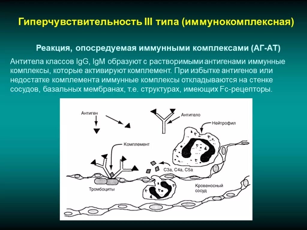 Иммунная гиперчувствительность. 3 Тип гиперчувствительности. Иммунокомплексный Тип гиперчувствительности. Реакция гиперчувствительности 3 типа. Схема реакции гиперчувствительности 3 типа.