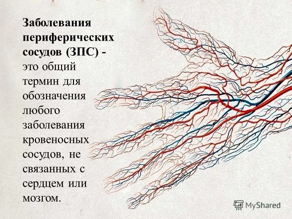 Заболевания артерий вен