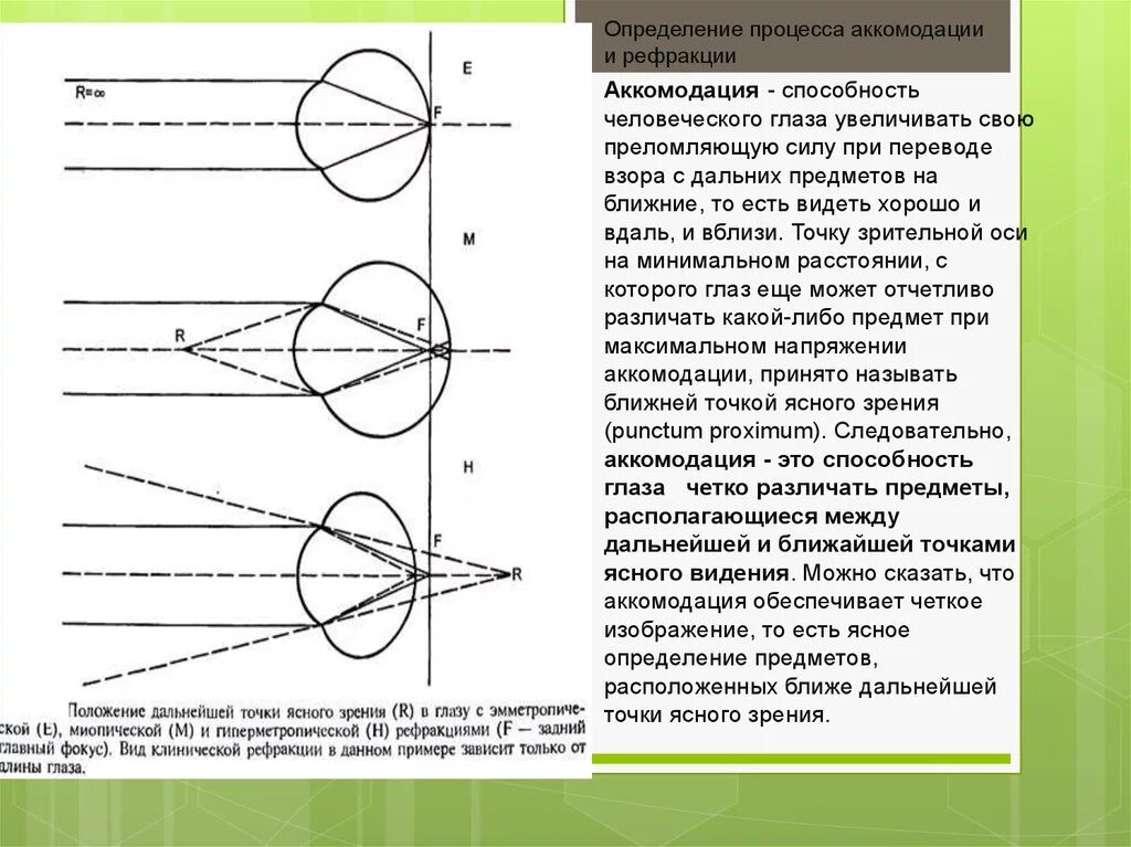 Аккомодация определение. Состояния аккомодации глаза таблица. Рефракция глаза при напряжении аккомодации. Состояние напряжения аккомодации фокус. Состояние оптического стресса аккомодации фокус на сетчатке рисунок.