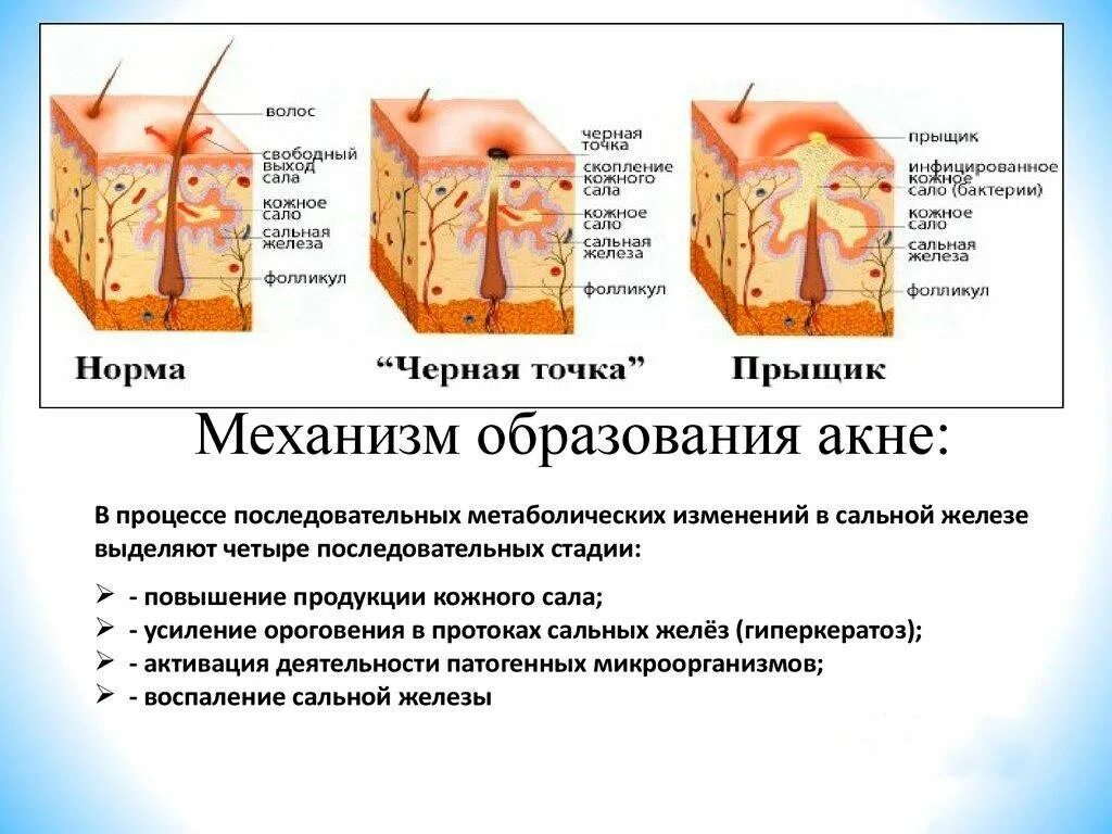 Как избавиться от прыща на языке