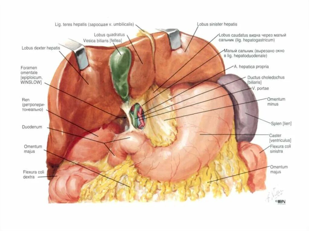 Винслово отверстие. Сальниковая сумка брюшины анатомия. Печеночная преджелудочная и сальниковая сумки. Печень и брюшина анатомия. Анатомия печени Неттер.