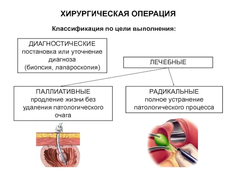 Методы хирургических операций. Схема этапов хирургического вмешательства. Классификация хирургических операций. Классификация хирургических операций по целям. Цель хирургической операции.