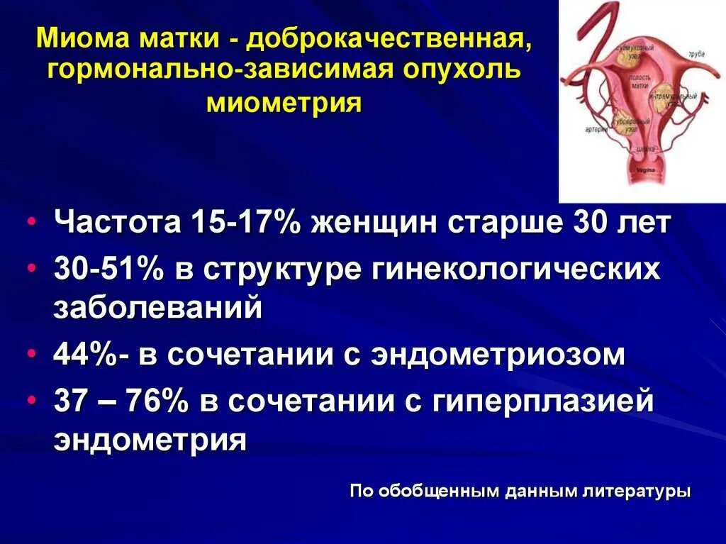 Удалять ли матку отзывы. Миома матки презентация. Симптоматика миомы матки. Миома матки и эндометриоз.