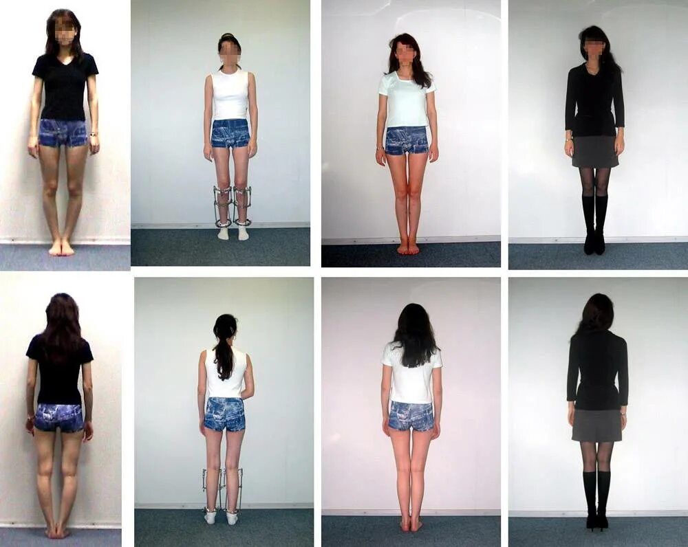 Кривые ноги в юбке. Скрыть кривизну ног платья. Одежда скрыть ноги. Одежда для женщин с кривыми ногами. Юбка с кривыми ногами.