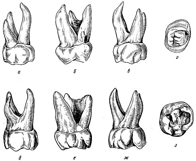Первый моляр верхней челюсти. Второй верхний моляр анатомия. 1 Моляр верхней челюсти анатомия.