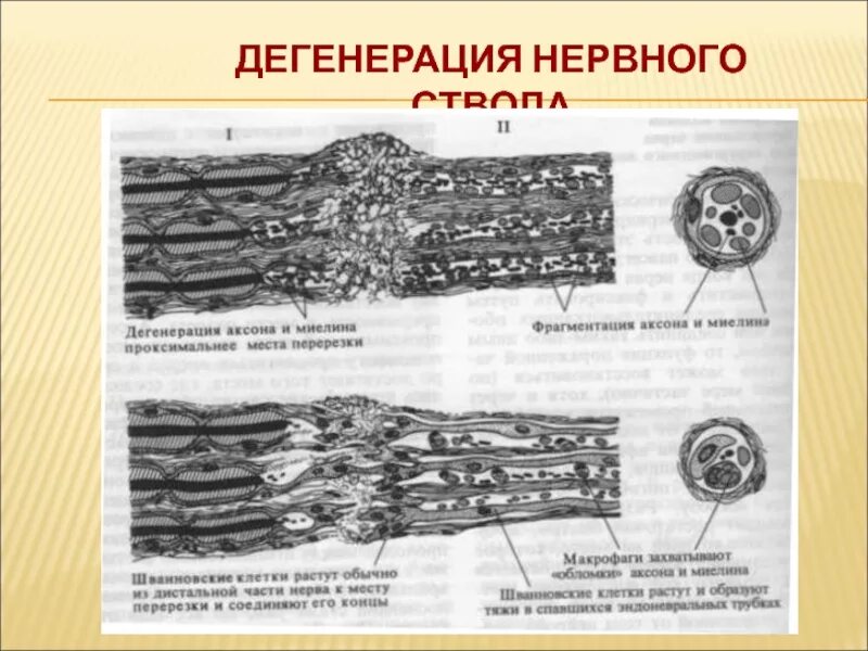 Дегенерация. Дегенерация и регенерация нервных волокон. Дегенерации, регенерации нервной ствола. Дегенерация периферического нервного волокна..