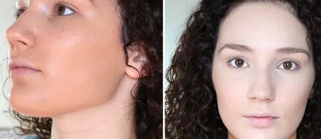 Неравномерный цвет лица. Шея темнее лица. Шея темнее лица. Под волосами на шее темная кожа. Шея темнее лица.