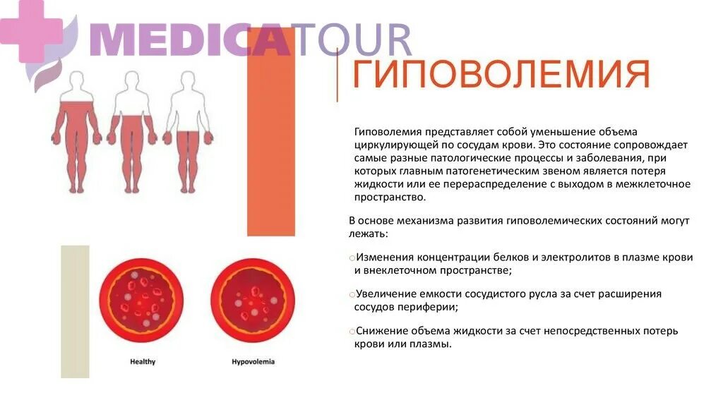 Тошнота после приема пищи у женщин. Гиповолемия. Гиповолемия симптомы. Кружится голова после еды. Гиповолемия это в медицине.