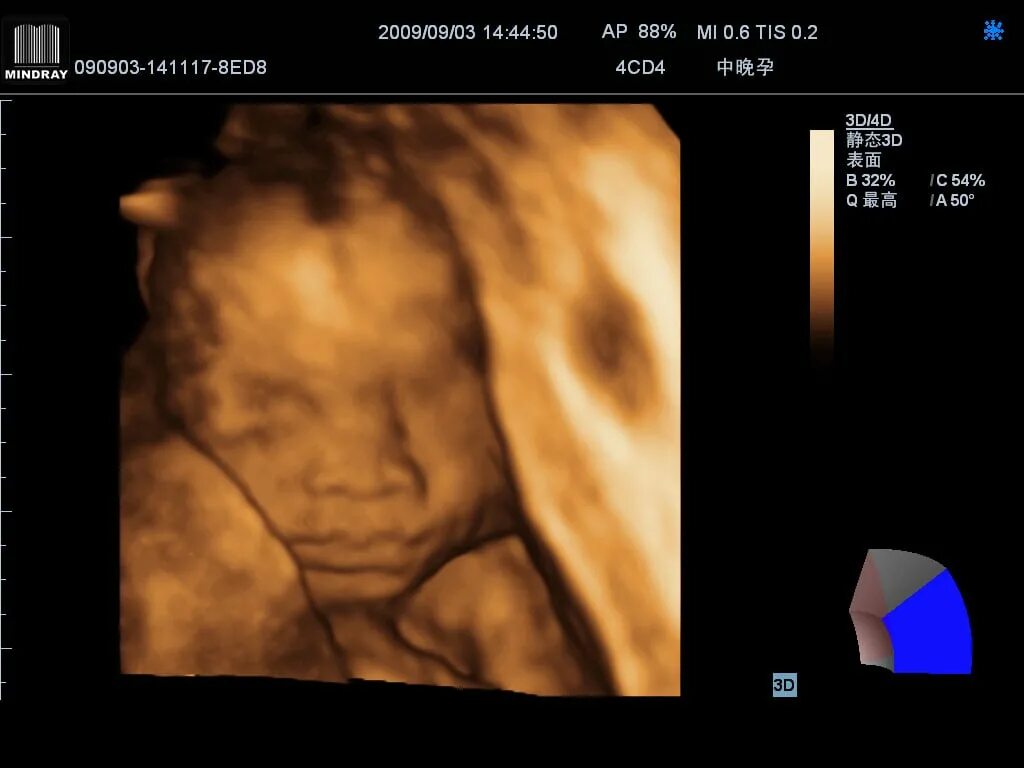 Узи допплер аппарат. Узи почек с доплером. Узи доплер ребенку. Ультразвуковое исследование. Допплер плода при беременности.