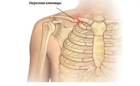Симптомы ключицы