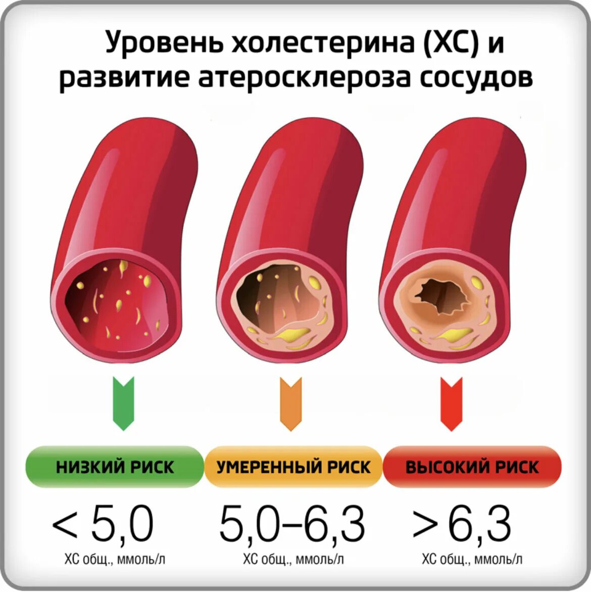 Уровень нормальный уровень холестерина в крови. Атеросклероз сосудов показатели крови. Повышение уровня холестерина в крови. Высокий холестерин в крови. Что значит сильная кровь