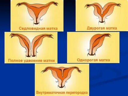 Матка бывает
