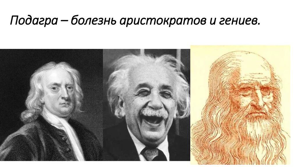 Подагра король. Болезнь королей и гениев. болезнь королей и аристократов. подагра болезнь гениев и королей.