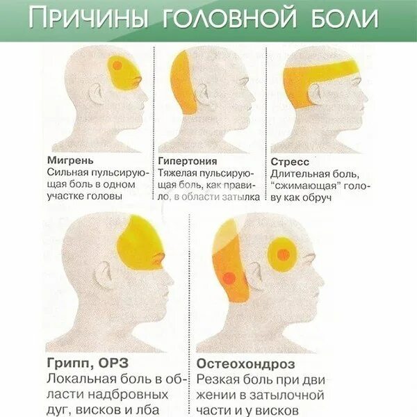 Лобная часть головы болит лечение. Схема локализации головной боли. Причины головной боли.