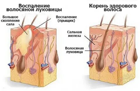 Много кожных желез