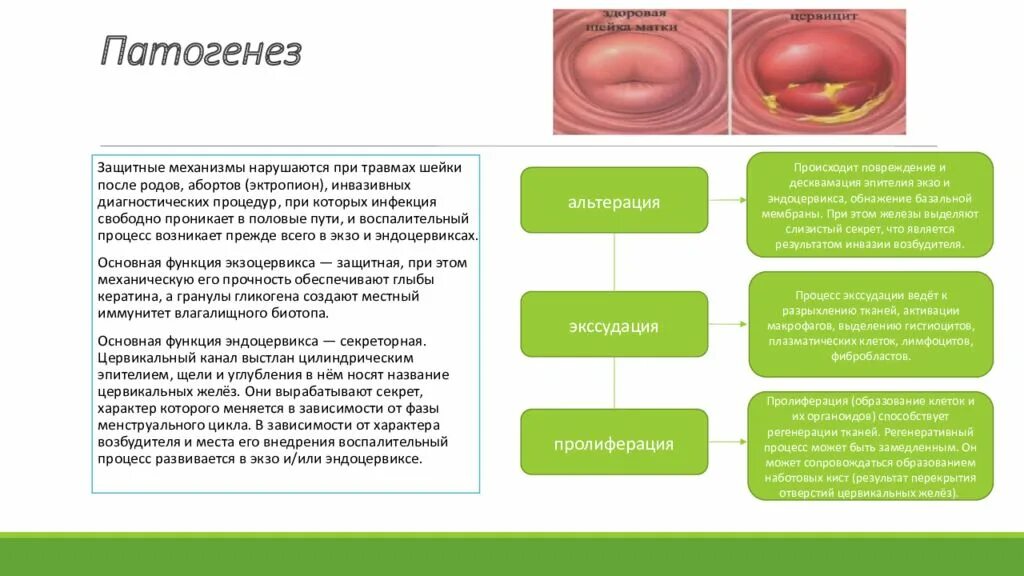 Цервицит что это у женщин причины. Эндоцервикальный эктропион. Воспалительная болезнь шейки матки n72. Патологии шейки матки этиология. Заболевания матки этиология.