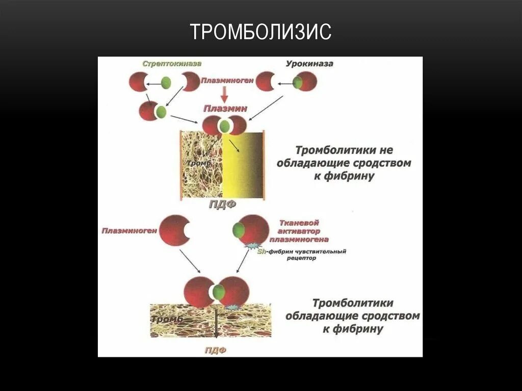 Регионарный катетерный тромболизис. Системный тромболизис. Селективный внутриартериальный тромболизис. Тромболитики схема.