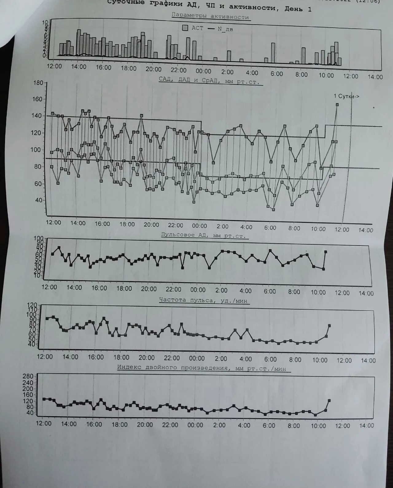 Суточный мониторинг пульса. Суточный мониторинг ад. Схема суточного мониторинга. Суточный мониторинг артериального давления фото.