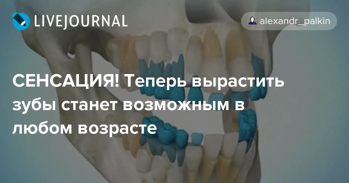 Прорезается зуб мудрости. Может ли заново вырасти зуб. Можно вырастить зубы в любом возрасте. Вырывание зуба мудрости. Может ли заново вырасти зуб.