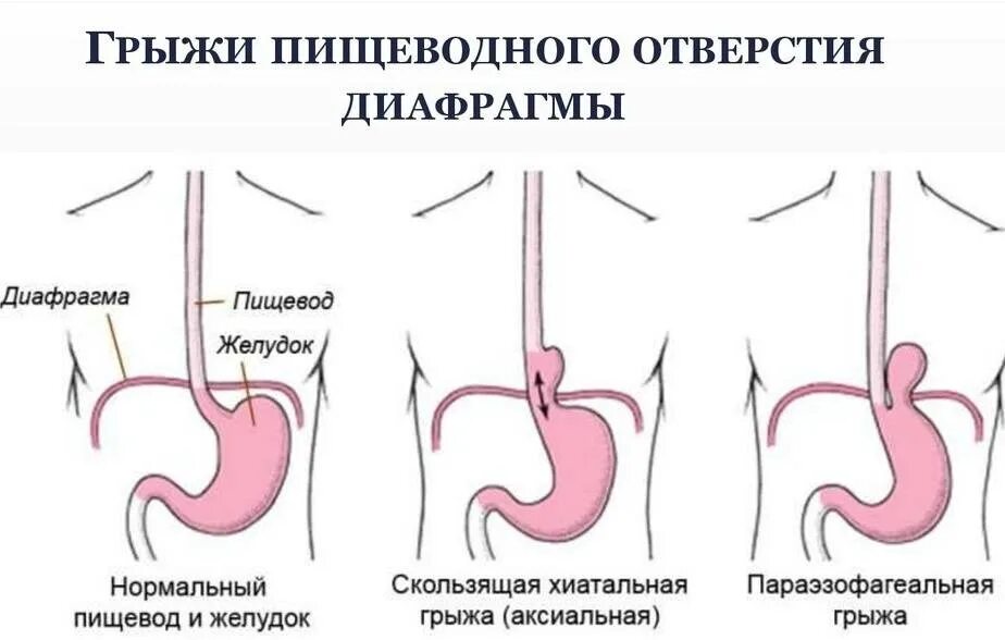 Гпод 1