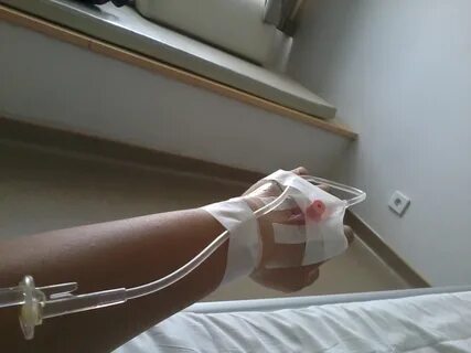 Kateter infus standar biasanya digunakan untuk beberapa jenis metode infus ...