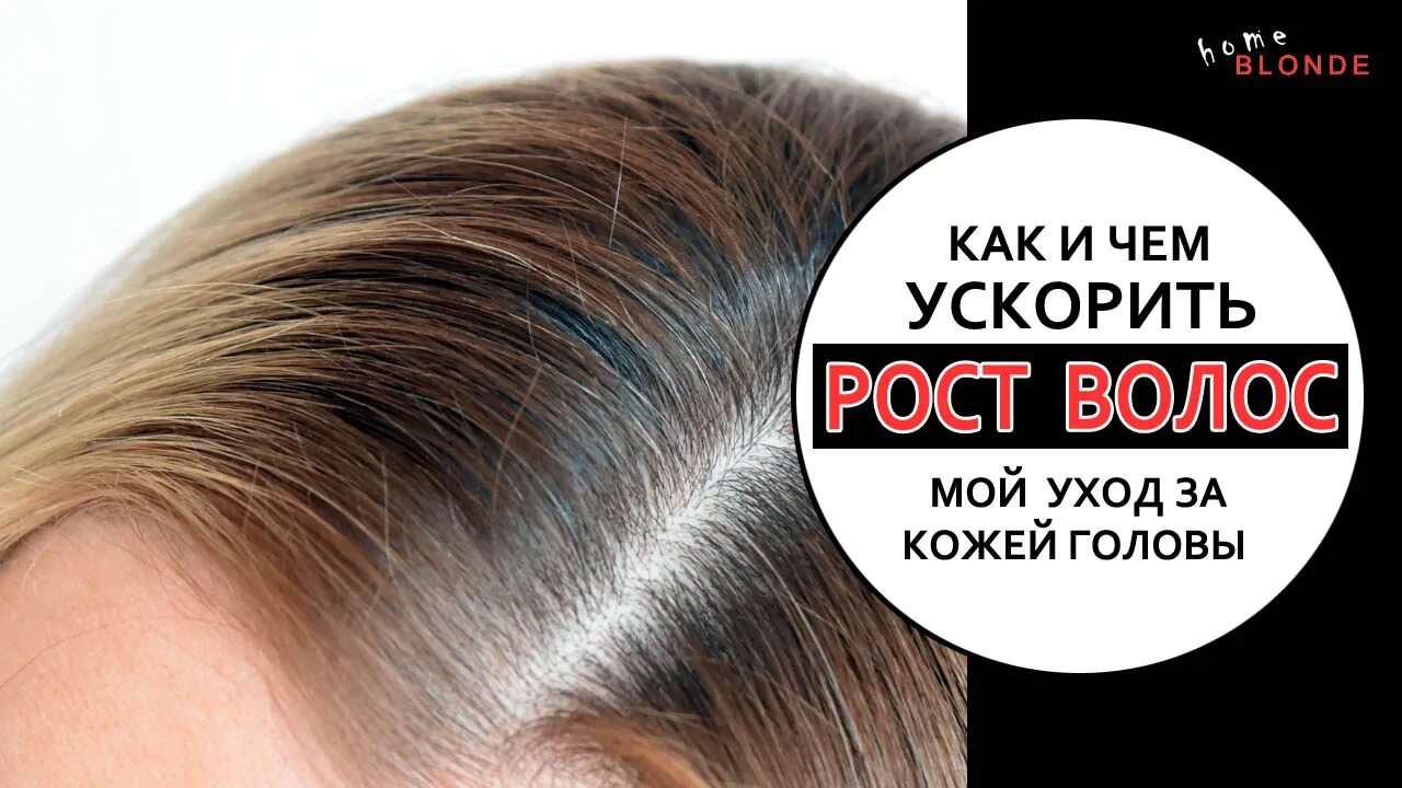 Ускорение роста волос. Как ускорить рост волос. Как убыстрить рост волос. Ускоренный рост волос. Как усилить рост волос