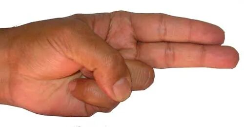 Мудры для похудения рук. Сурья мудра для похудения. Мудры для похудения для женщин. Мудра для похудения. Мудры для похудения для женщин.