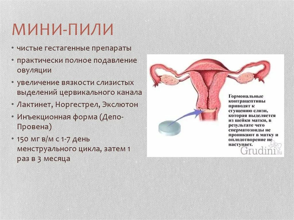 Мини пили обзор. Гестагенные контрацептивы мини пили. Механизм действия мини пили. Мини пили. Таблетки мини пили.