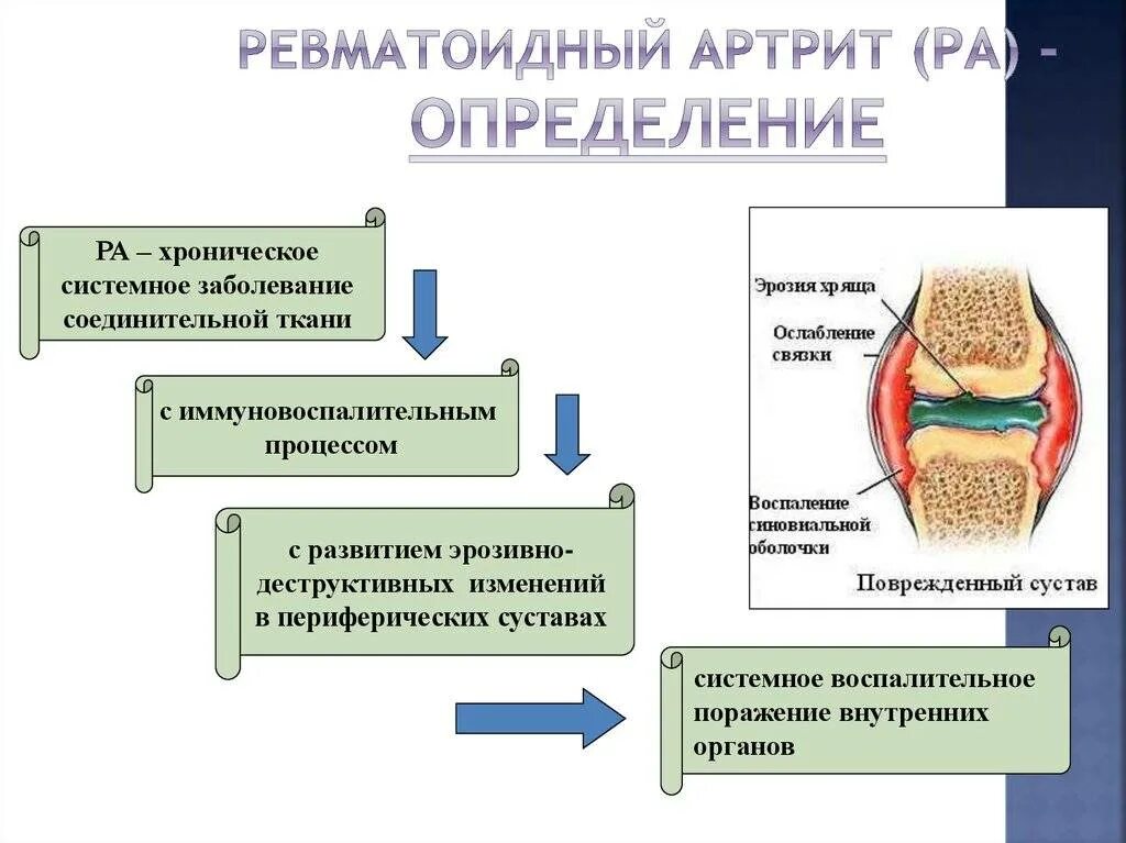 Ревматоидного артрита у детей клинические. Ревматоидный артрит суставов патогенез. Симптомы поражения суставов ревматоидного артрита. Основные клинические проявления ревматоидного артрита. Системные заболевания соединительной ткани.