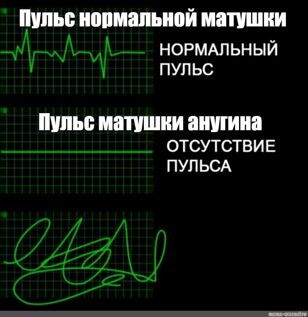 Кто поет с моего пульса убери. Пульс Мем. Сердцебиение Мем. Странный пульс. Нормальный пульс.