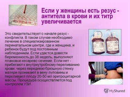 Анализ на антитела при резус конфликте