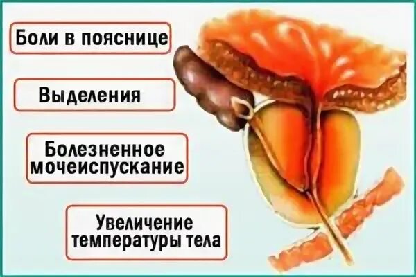 Где находится простатит