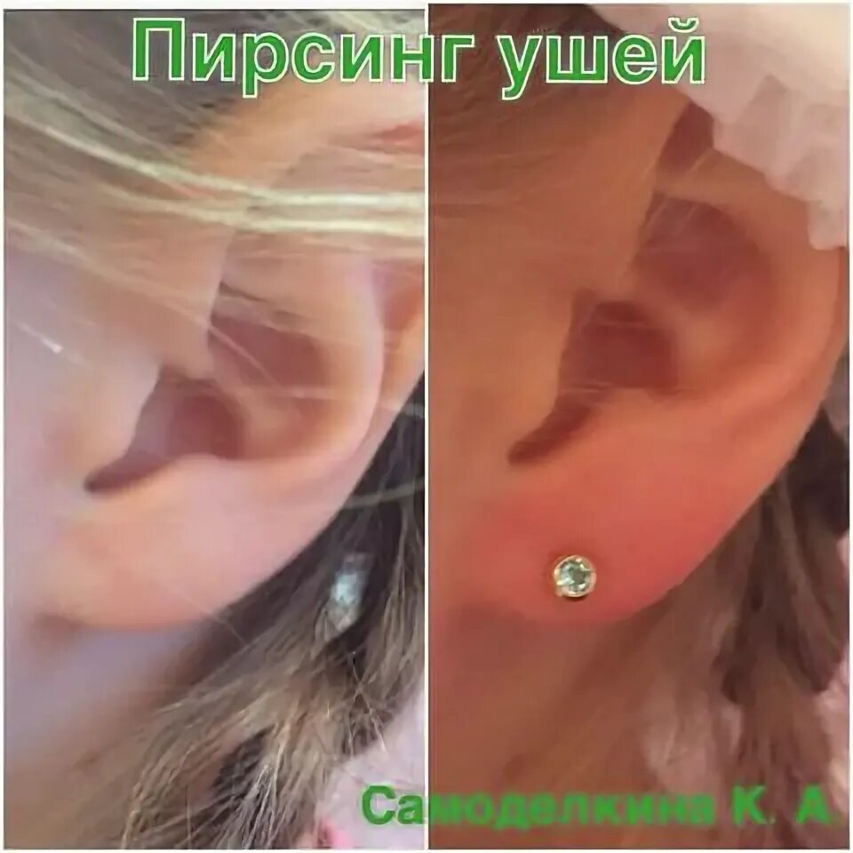 Чтобы уши быстро зажили