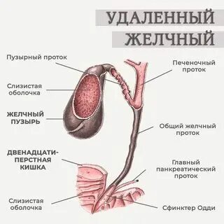 Как жить после удаления желчного
