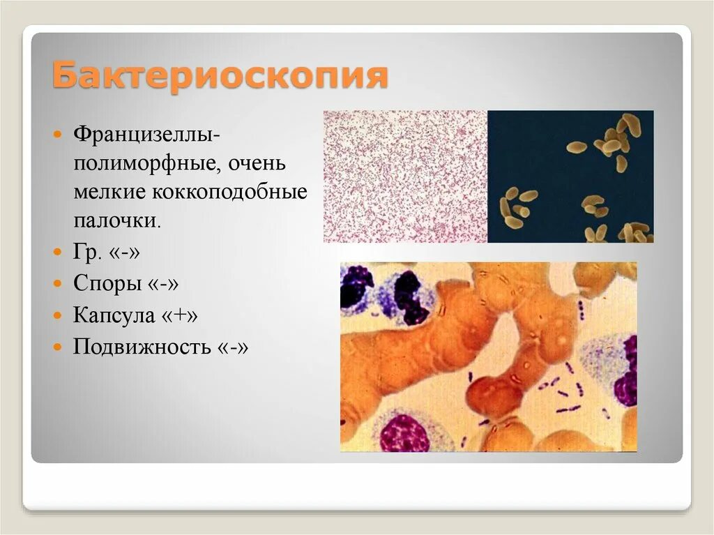 Prevotella микробиология. Крупные грамположительные палочки. Грамотрицательные изогнутые палочки. Полиморфные палочки что это такое. Грамм положительные палочки морфология.