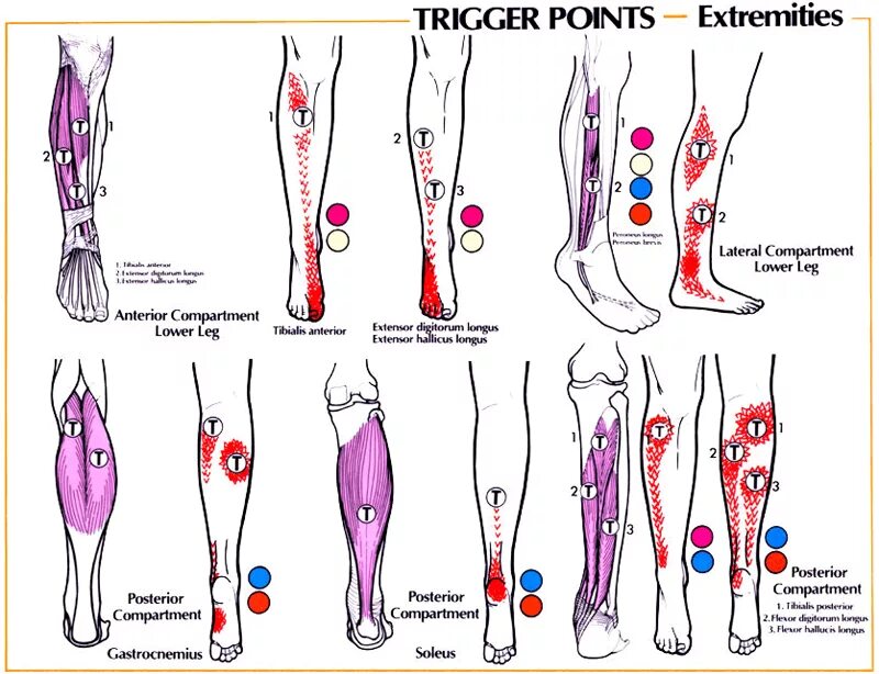 Боль в икрах причины у мужчин. Триггерные точки мышц стопы и голени. Триггерные точки мышц стопы. Массаж триггерных точек голени. Триггерные точки на стопах ног схема.