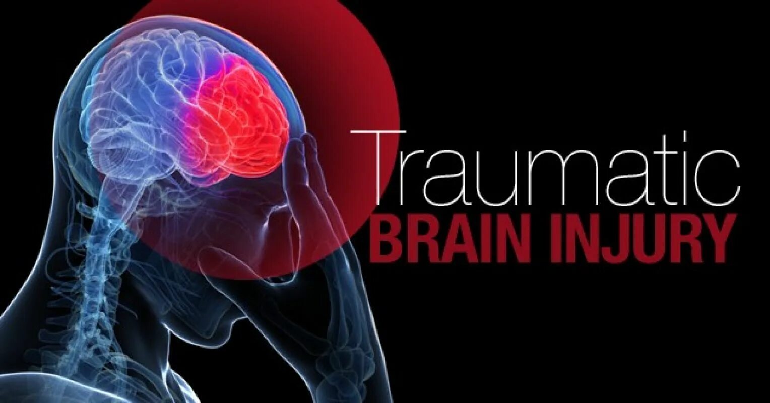 Травматических повреждений мозга. Повреждение головного мозга. Медицина мозг. Traumatic Brain injury Symptoms.