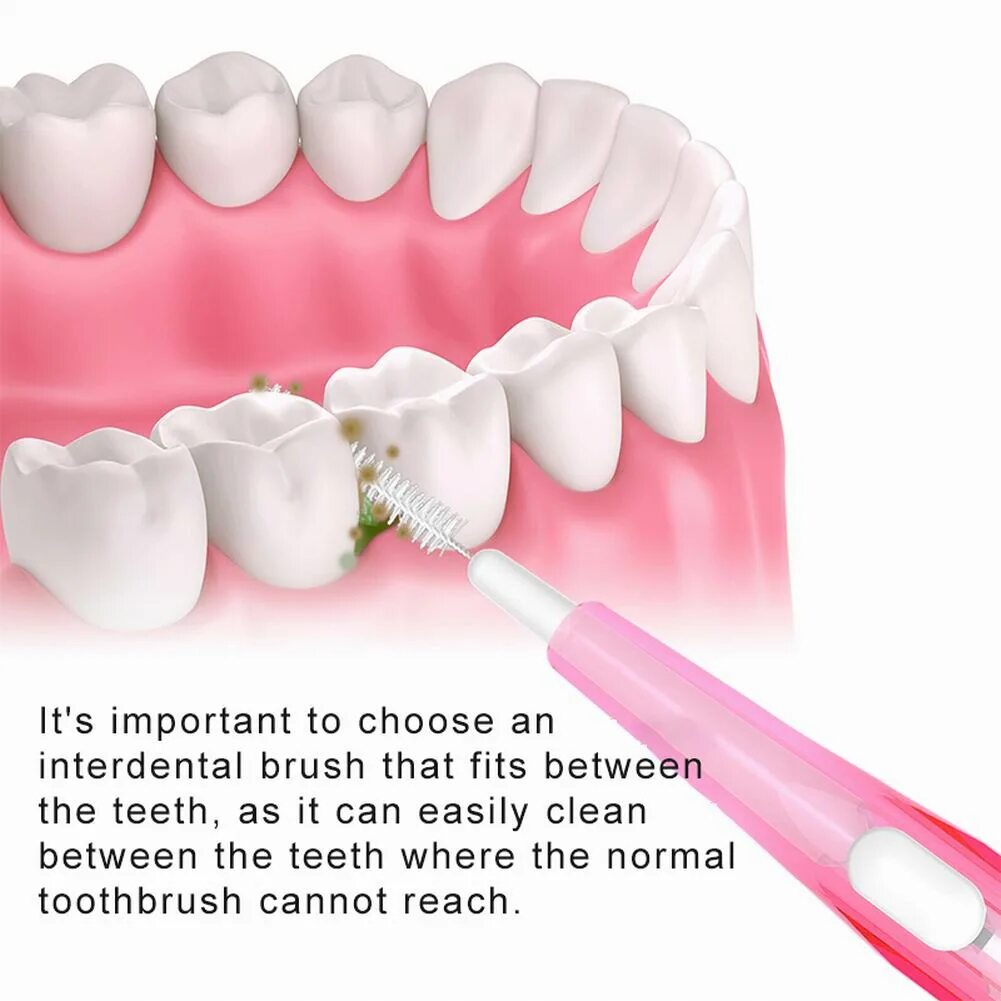 Для чистки между зубами. Средство для очистки между зубами. Пластины для чистки между зубов. Полоски для чистки между зубов. Прибор для чистки между зубами.
