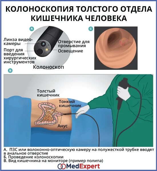 Как называется процедура проверки кишечника трубкой. Как называется процедура проверки кишечника трубкой
