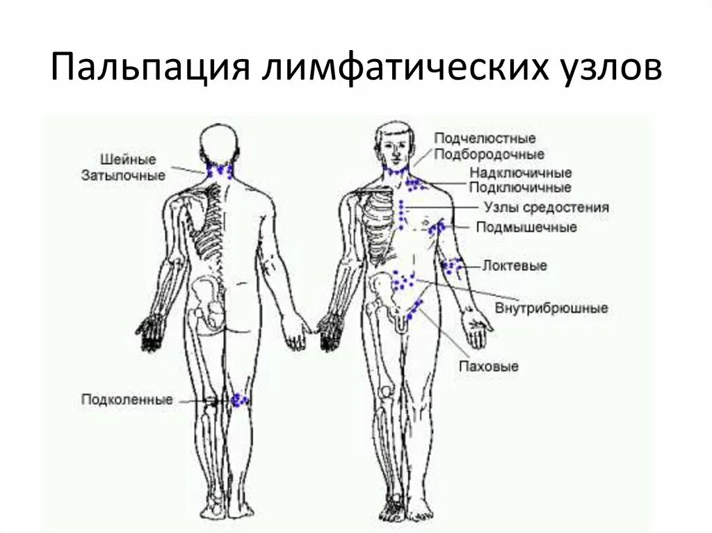 Лимфатическая система ребенка схема. Лимфоузел схема на теле. Схема лимфатических узлов человека. Пальпация лимфоузлов схема.