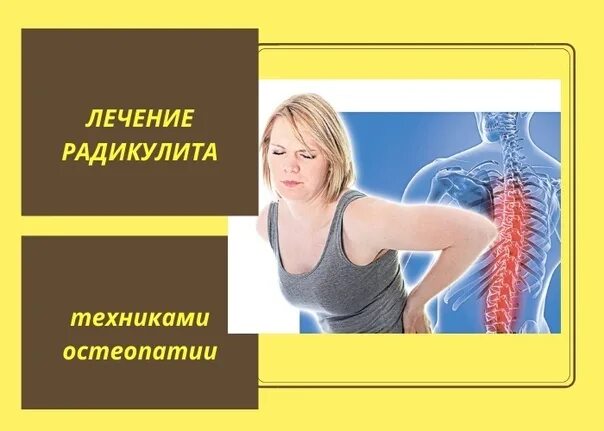 Радикулит лечение у женщин. Радикулит лечение у женщин. Боль в позвоночнике поясница женщина. Пояснично-крестцовый радикулит. Радикулит симптомы.