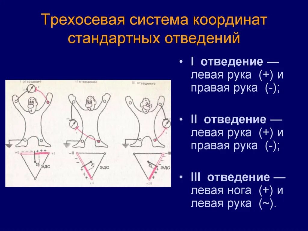 Стандартные отведения ЭКГ. Стандартная система отведений ЭКГ. Правые и левые отведения на ЭКГ. 3 Стандартное отведение ЭКГ. Правые грудные отведения