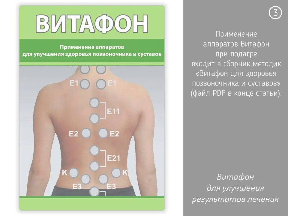 Витафон инструкция отзывы. Аппарат фонирования для позвоночника. Прибор Витафон точки для спины. Аппарат Витафон точки воздействия. Витафон точки фонирования.