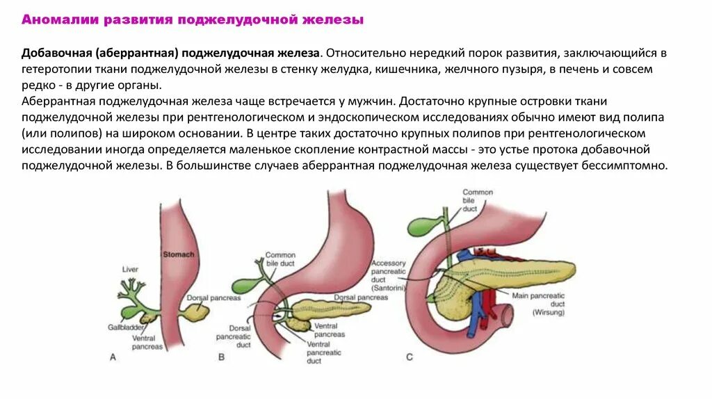 Лечение поджелудочной желчного пузыря. Загиб поджелудочной железы. Абберантная поджелудочная железа. Поджелудочная железа с перегибом у грудничка. Аберрантная поджелудочная железа симптомы.