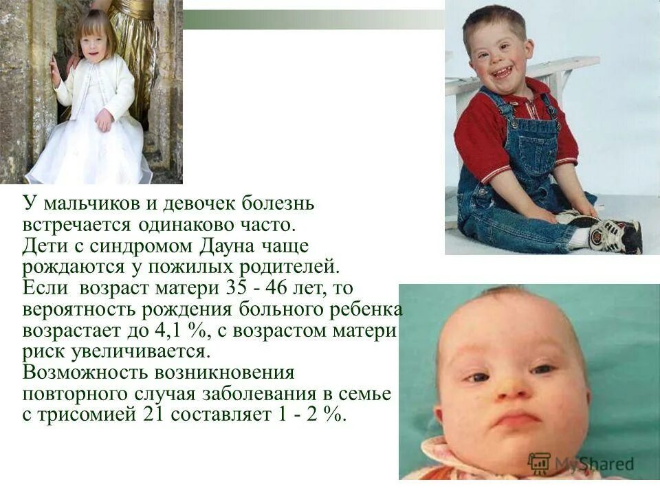 родился ребенок с синдромом дауна. дети с синдромом дауна рождаются. дети дауна. дети рожденные с синдромом дауна. ребенок даун.