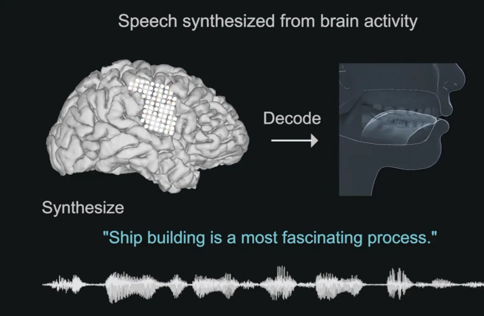 Speech Synthesis. Brain activity. Мозг и Ноты вокруг. Синтез речи картинки.